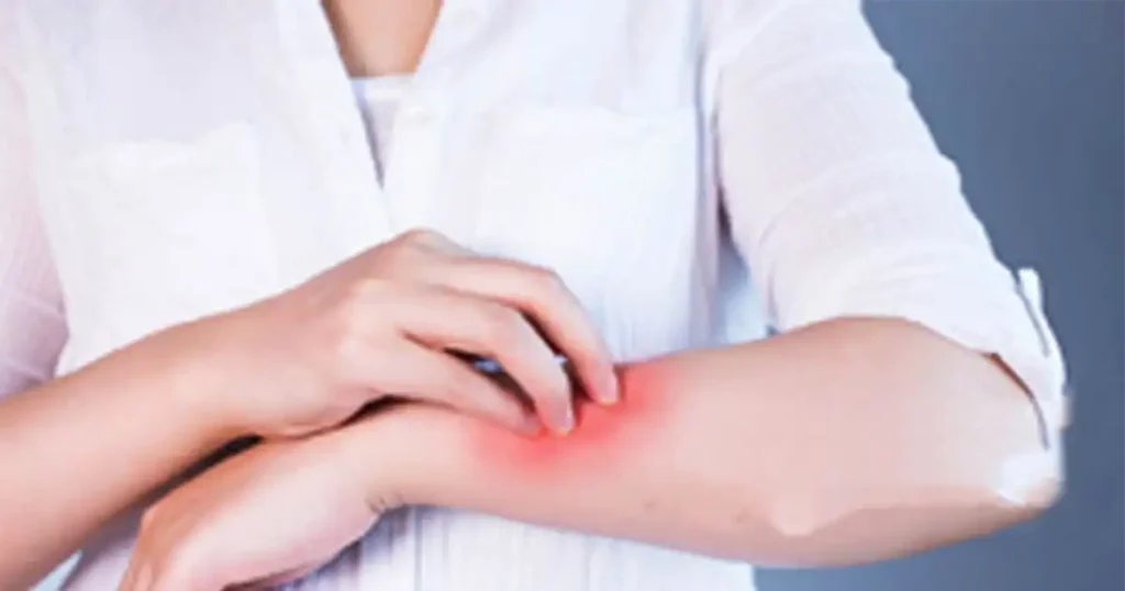 major skin allergy triggers