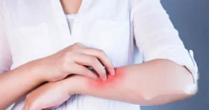 major skin allergy triggers