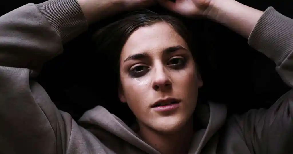 dark circles under eyes