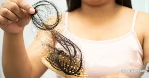 Hair fall treatment by dermatologist hair regrowth treatment