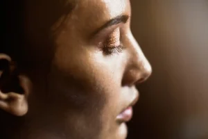 How to Reduce Oily Skin on Face: Expert Tips from a Skin Doctor