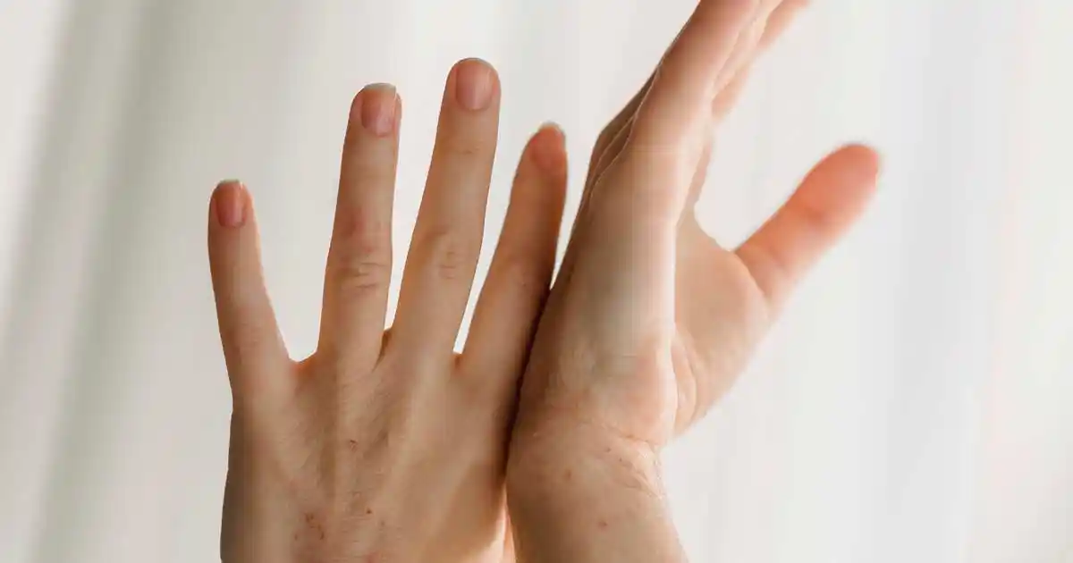 how to prevent eczema