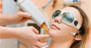 how to remove mole safely