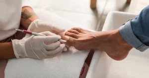 yellow nails causes and treatment