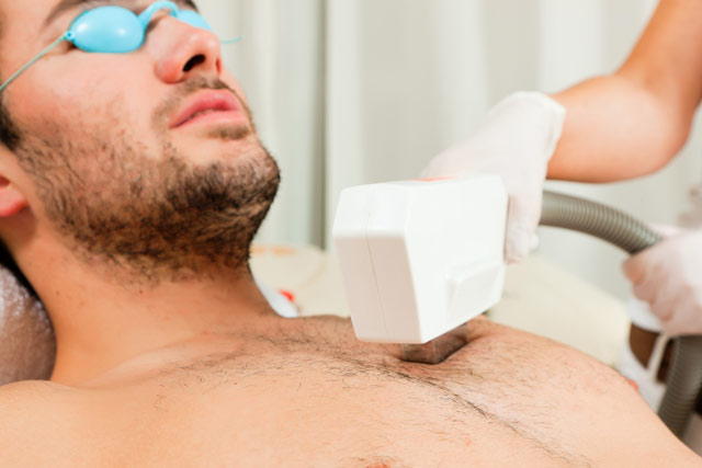 Best Laser hair removal treatment clinic in Delhi, India