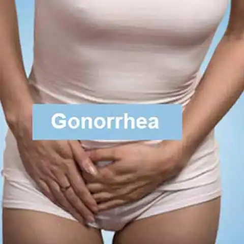 gonorrhea(STD Disease) treatment in Delhi