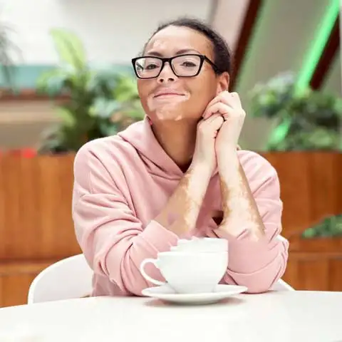 Vitiligo Specialist Doctor in South Delhi